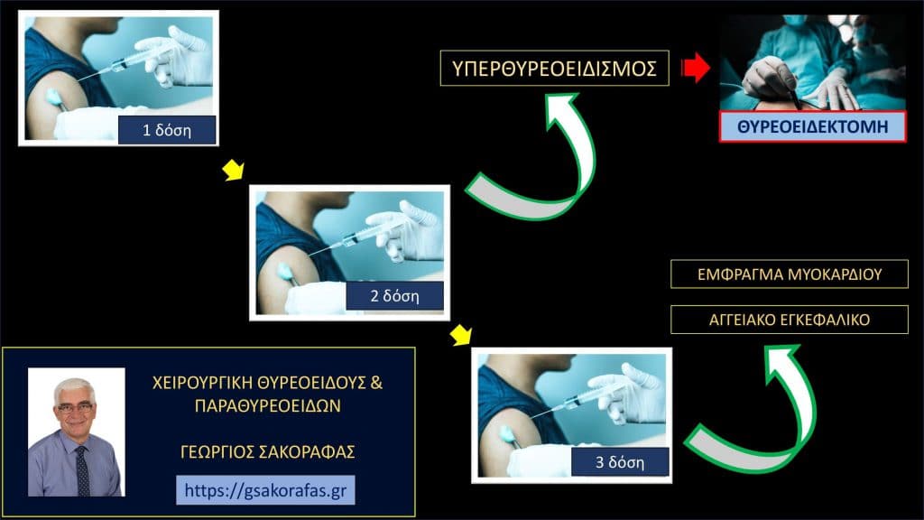 Υπερθυρεοειδισμός, έμφραγμα μυοκαρδίου και αγγειακό εγκεφαλικό επεισόδιο σε νεαρό ασθενή μετά από εμβολιασμό για τον κορονοϊό (Covid-19). Ολική θυρεοειδεκτομή σε δεύτερο χρόνο.