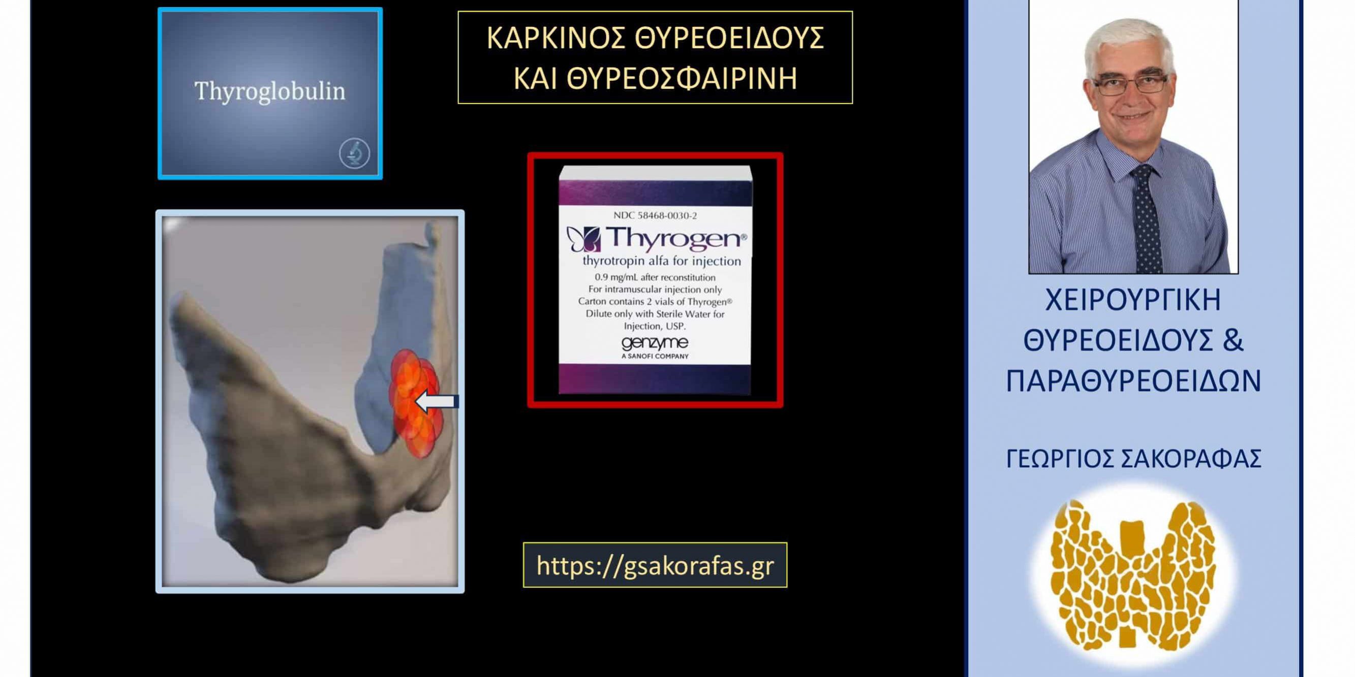 Θυρεοσφαιρίνη καρκίνος θυρεοειδούς (βασική και μετά διέγερση)