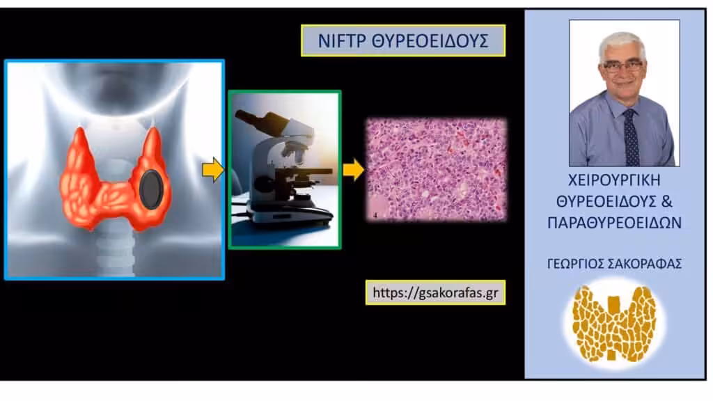 Niftp Θυρεοειδούς - Διάγνωση Niftp Θυρεοειδούς - Διάγνωση