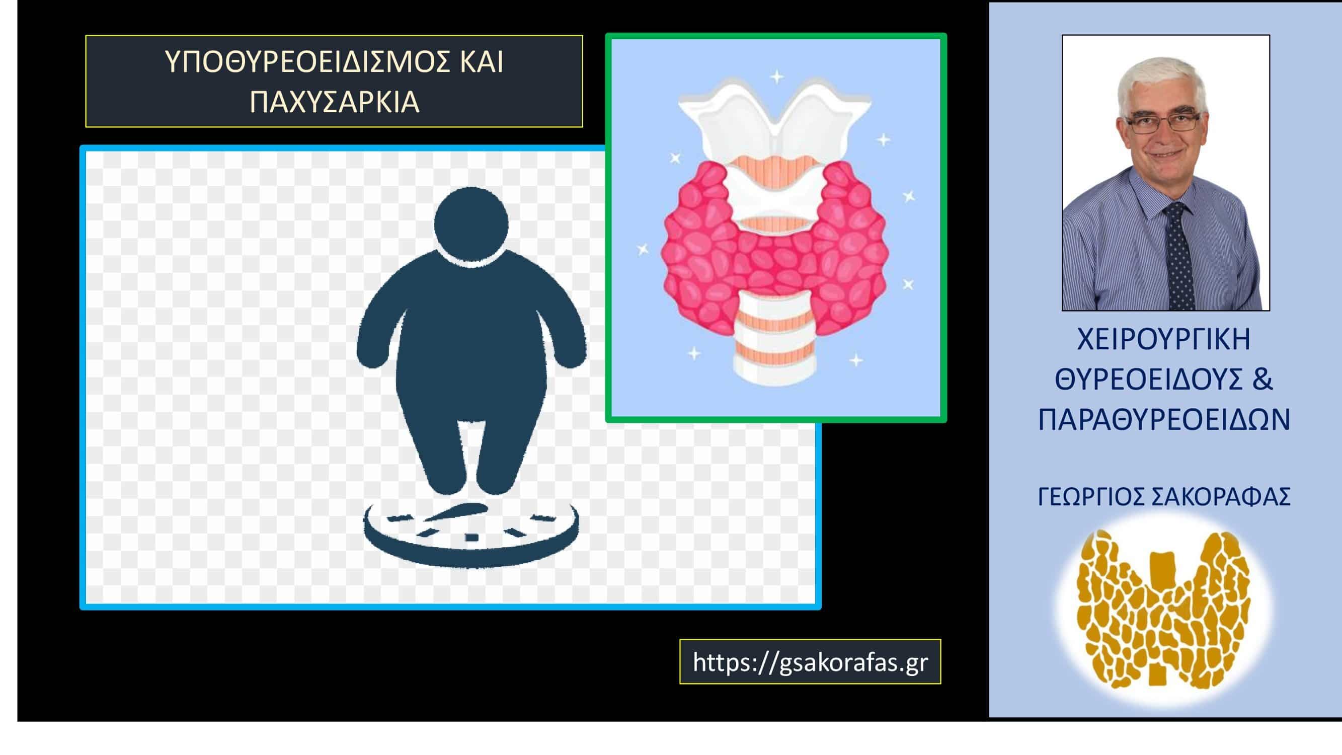 Υποθυρεοειδισμός και παχυσαρκία – “θα χάσω βάρος μετά τη θεραπεία του υποθυρεοειδισμού?”