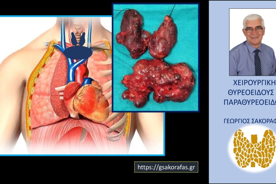 Καταδυόμενος όζος θυρεοειδούς και υπερηχογράφημα – λάθη, περιορισμοί και μία λεπτομέρεια μεγάλης σημασίας