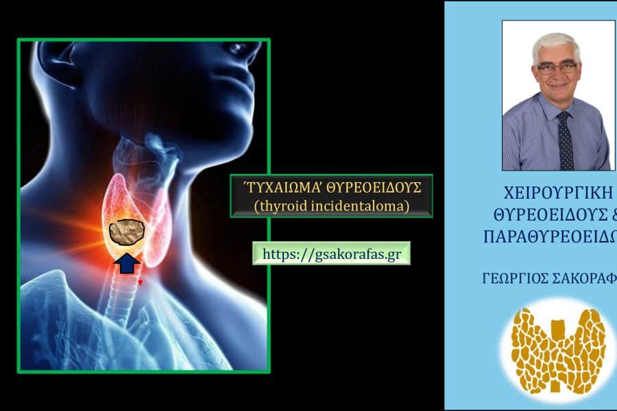 Τυχαίωμα θυρεοειδούς (thyroid incidentaloma) – Τι είναι? Πώς αντιμετωπίζεται?