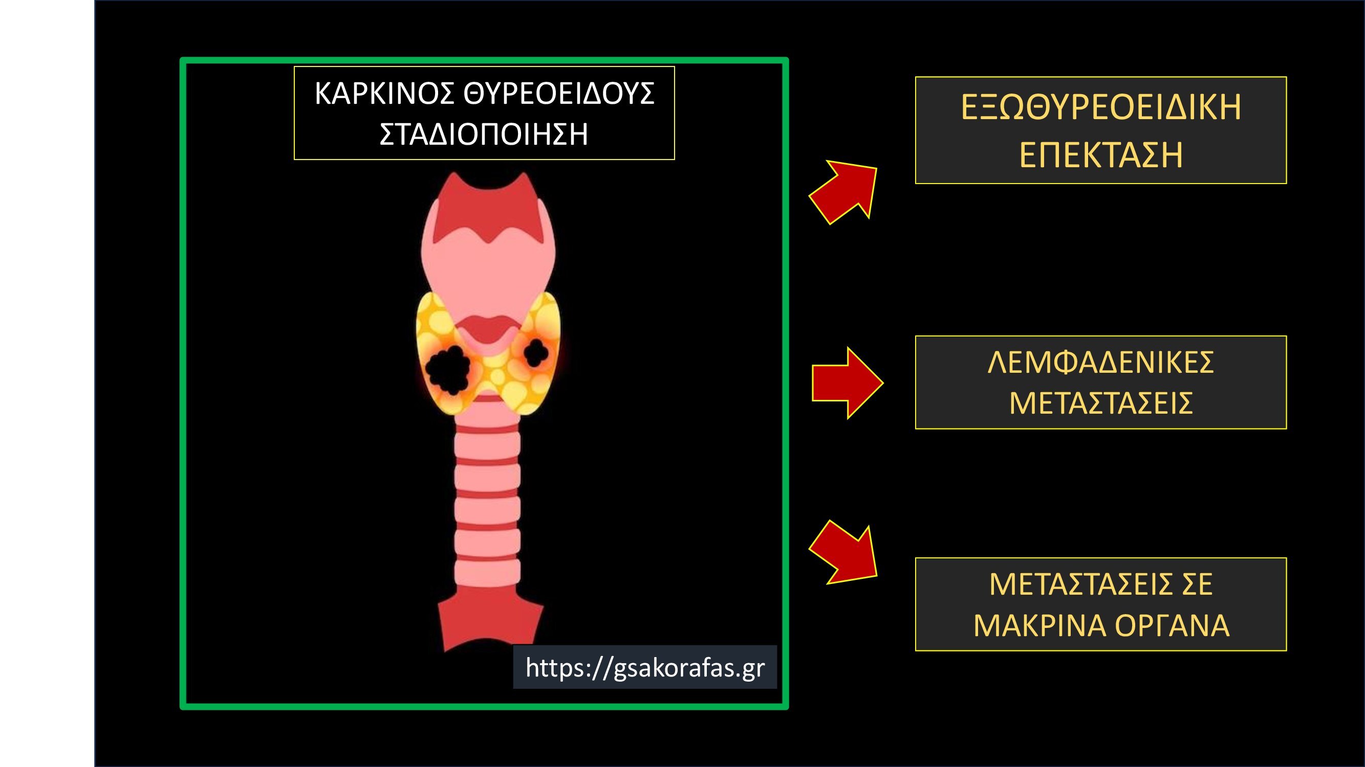 Καρκίνος θυρεοειδούς σταδιοποίηση: τί είναι και τι σημασία έχει στην πράξη?