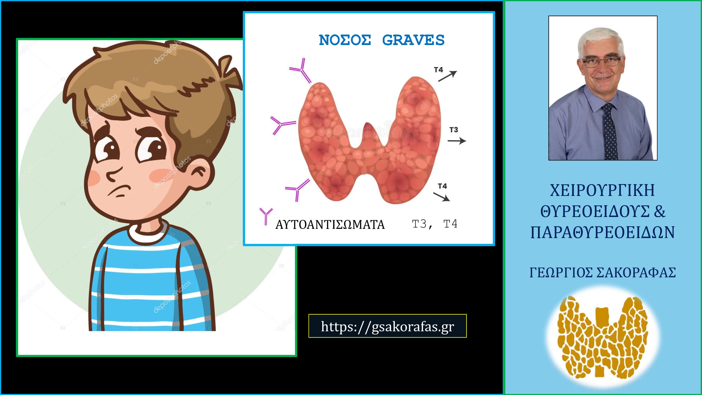 Υπερθυρεοειδισμός σε παιδί – ολική θυρεοειδεκτομή: ιδιαιτερότητες και δυσκολίες