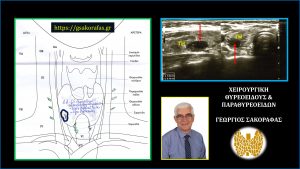 Αδένωμα Παραθυρεοειδούς Ενδοθυρεοειδικό Υπερηχογραφικά Ευρήματα