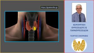 Παραθυρεοειδεκτομή 2 Και Η Απόφαση Για Χειρουργική Επέμβαση – Έχει Λόγο Ο Ασθενής?