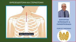 Επιμήκης Τραχηλική Τομή Στη Συνέχεια Της Στερνοτομής