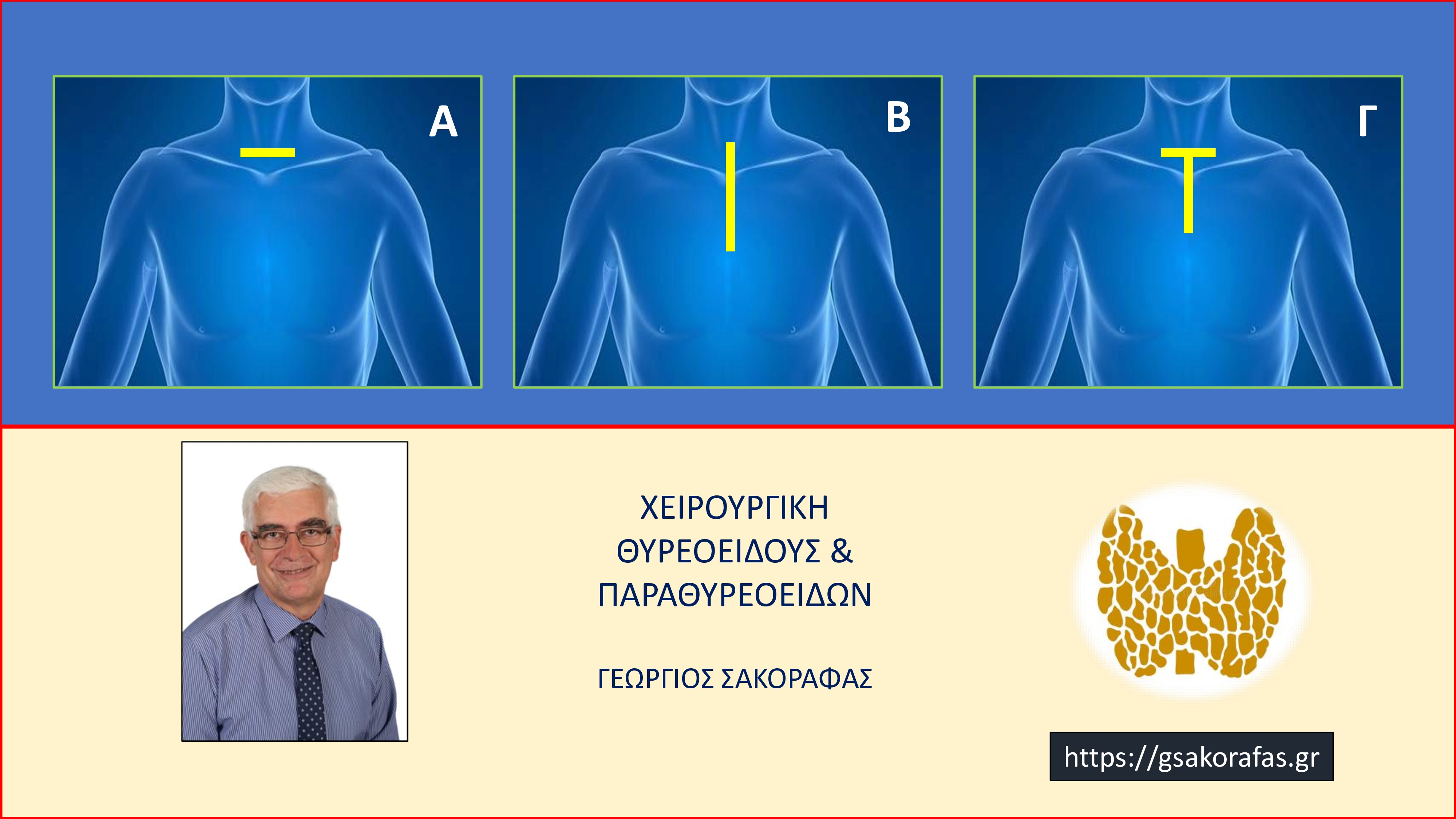 Καταδυόμενη βρογχοκήλη και στερνοτομή – θα χρειαστεί να γίνει για την αφαίρεση του θυρεοειδούς?