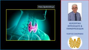 Θυρεοειδίτιδα Hashimoto Και Όζοι Θυρεοειδούς: Μπορεί Να Οδηγήσει Σε Καρκίνο Θυρεοειδούς;