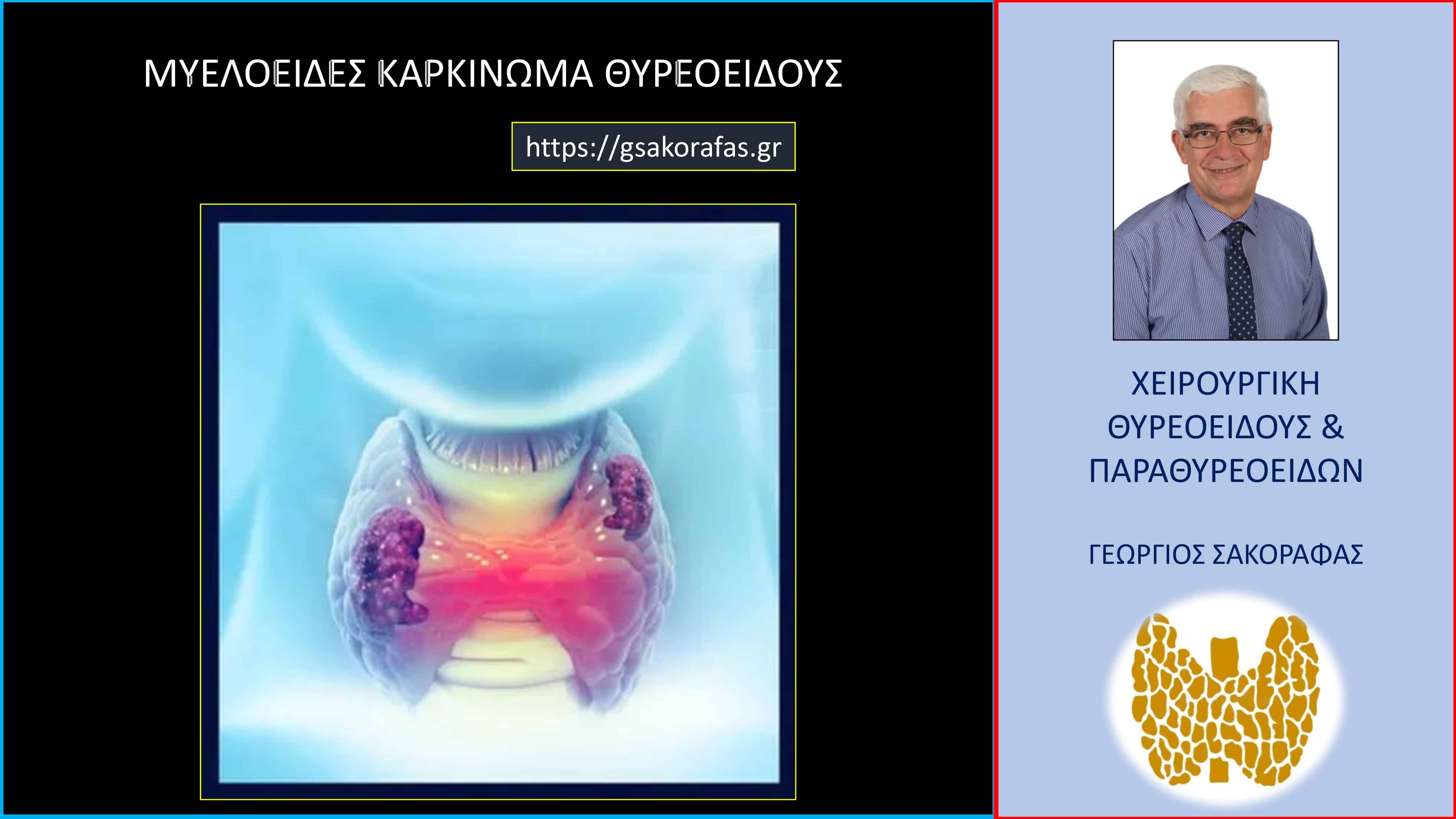 Μυελοειδές καρκίνωμα θυρεοειδούς 1c σαν τυχαίο εύρημα μετά από λοβεκτομή