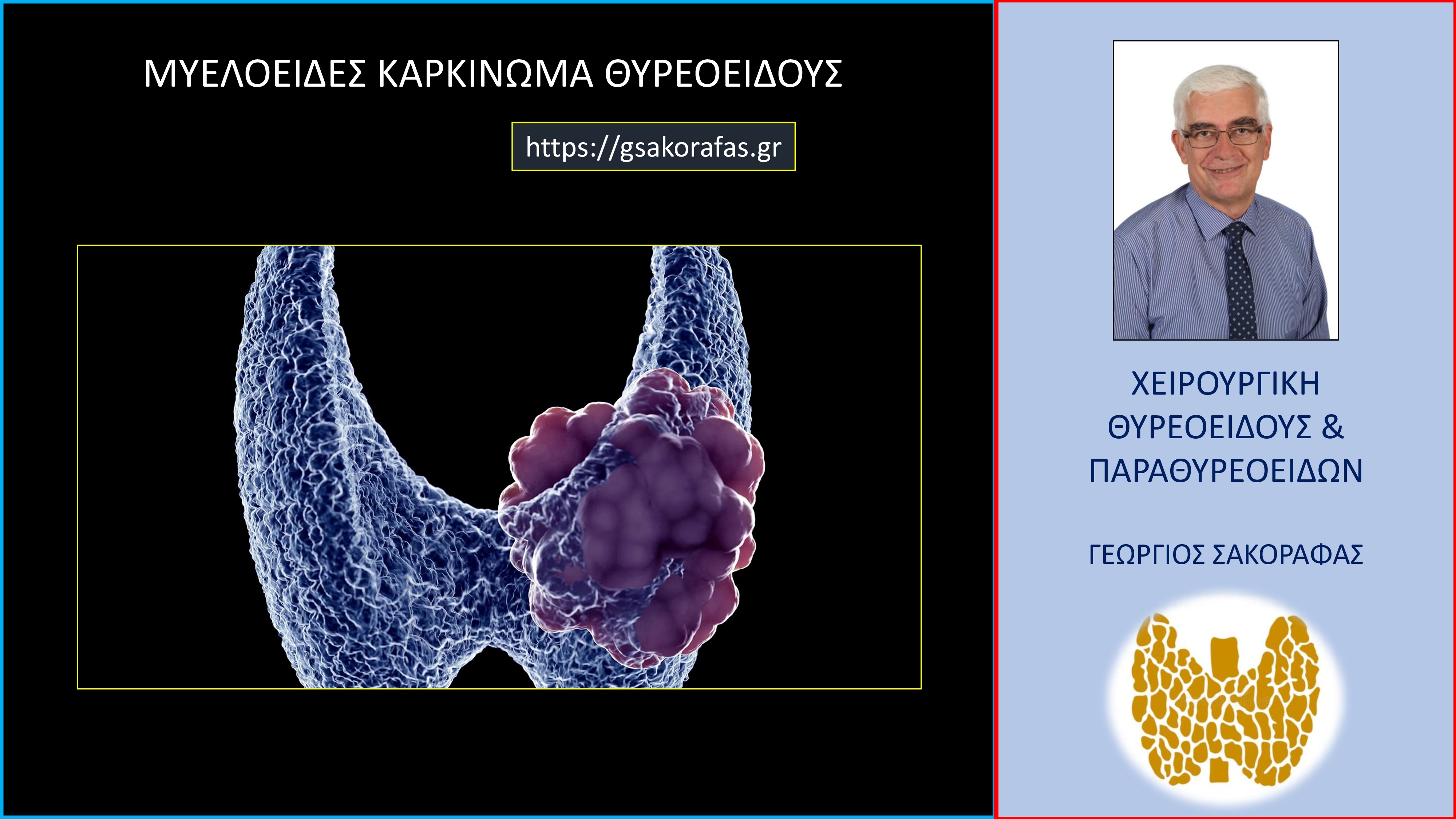 Μυελοειδής καρκίνος θυρεοειδούς σαν τυχαίο εύρημα μετά από λοβεκτομή