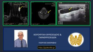 Κύστη Τραχήλου - Ευρήματα Στον Απεικονιστικό Έλεγχο (Τομές Σε Διαφορετικά Επίπεδα Αριστερά Και Μέσον Και Υπερηχογραφική Απεικόνιση Δεξιά)