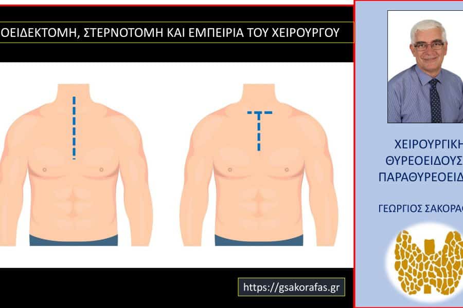 Θυρεοειδεκτομή στερνοτομή και η σημασία της εμπειρίας του χειρουργού