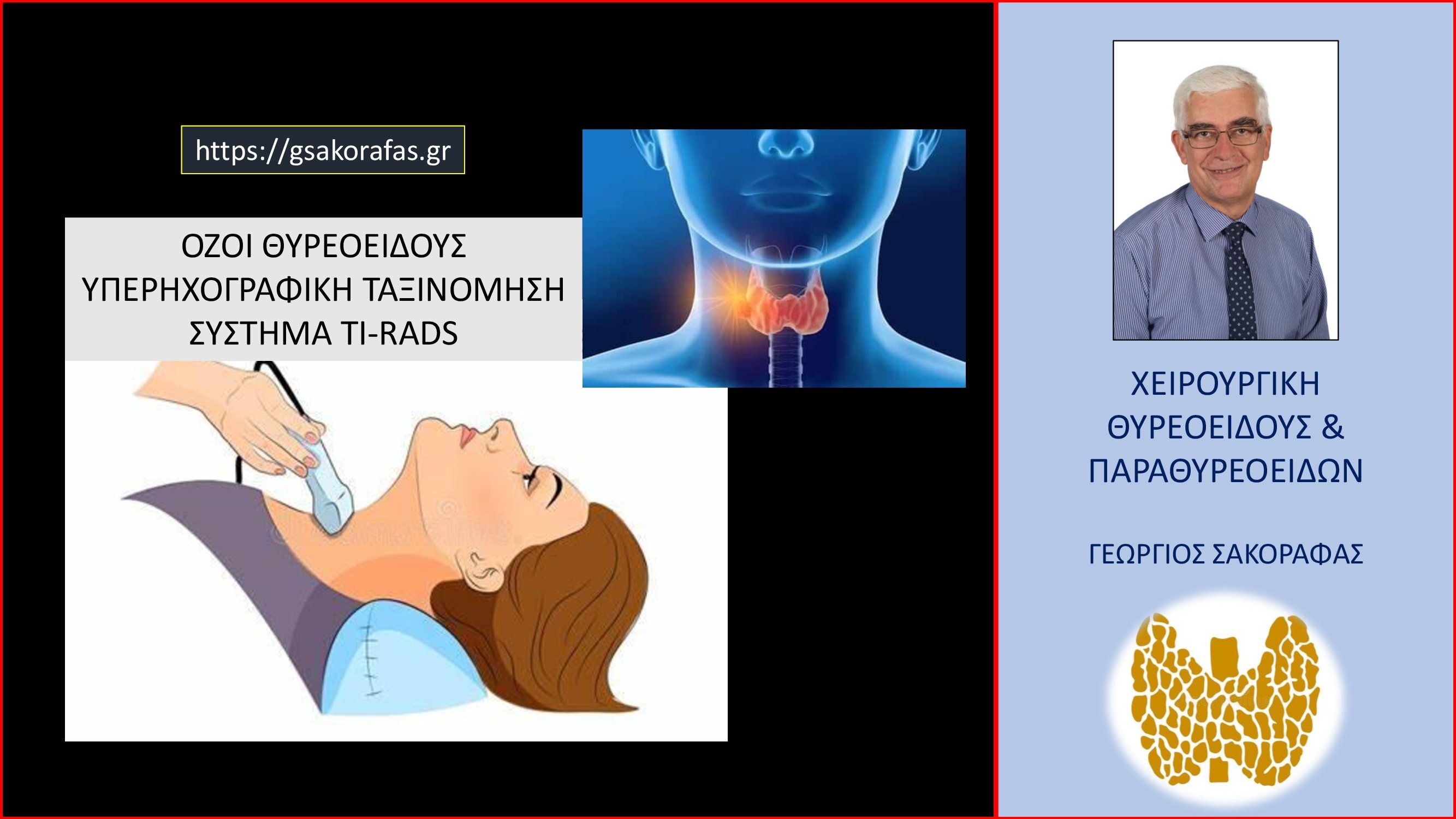 TI-RADS και όζοι θυρεοειδούς – Τι είναι η ταξινόμηση TI-RADS και ποια η χρησιμότητά της?