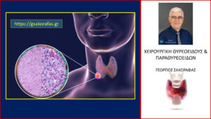 Καρκίνος Θυρεοειδούς Και Επιβίωση 3 – Μυελοειδής Καρκίνος