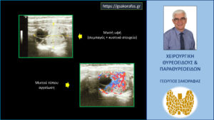 Υπερηχογραφικά Ευρήματα