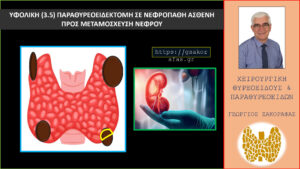 Υφολική Παραθυρεοειδεκτομή (3.5) Σε Ασθενή Με Τριτοπαθή Υπερπαραθυρεοειδισμό Και Χρόνια Νεφρική Ανεπάρκεια Σε Αναμονή Για Μεταμόσχευση Νεφρού