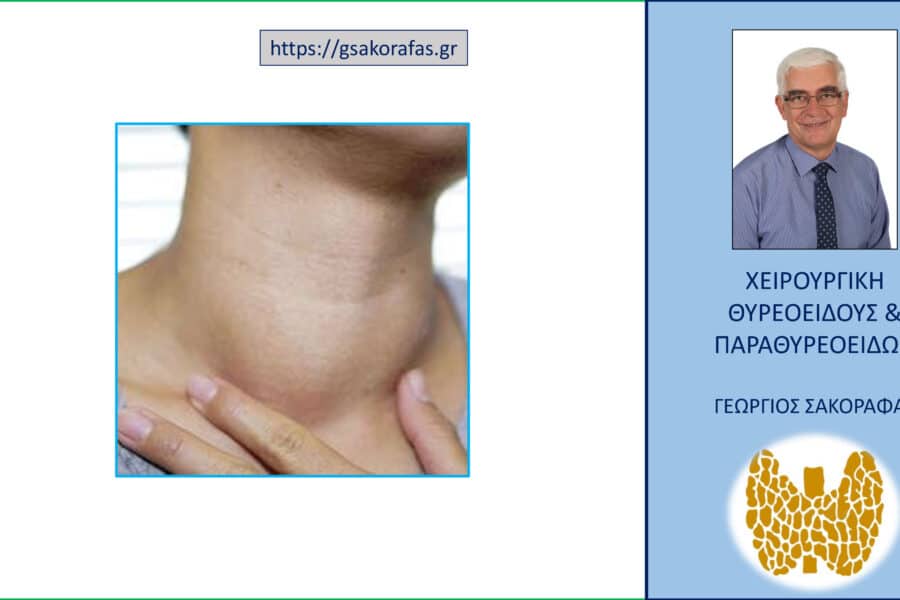 Βρογχοκήλη «με μια ματιά» από το «Α» ως το «Ω» – από τη διάγνωση στη θεραπεία