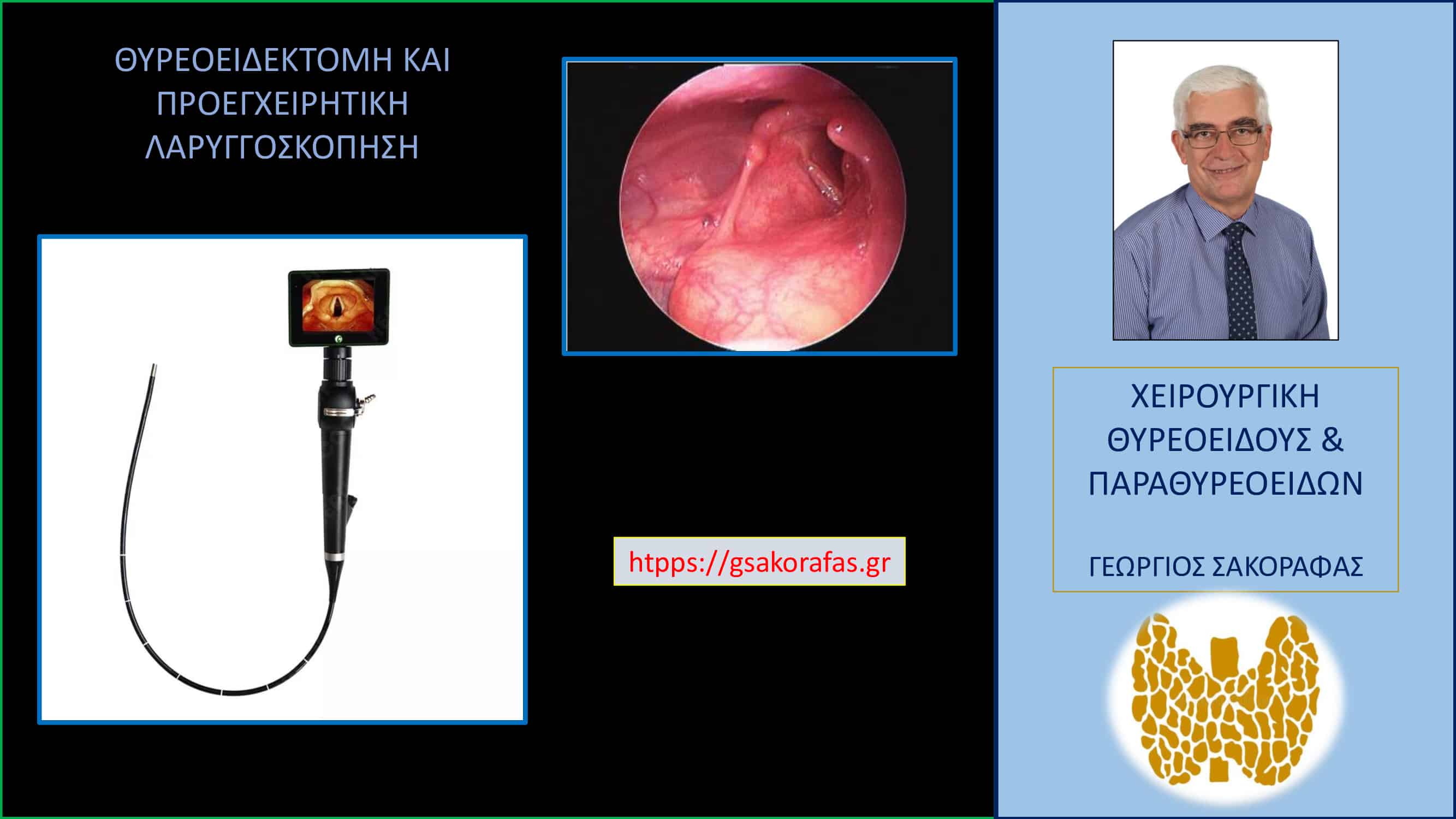 Θυρεοειδεκτομή και λαρυγγοσκόπηση πριν την επέμβαση – μία σημαντική ένδειξη (με αφορμή ασθενή μας)