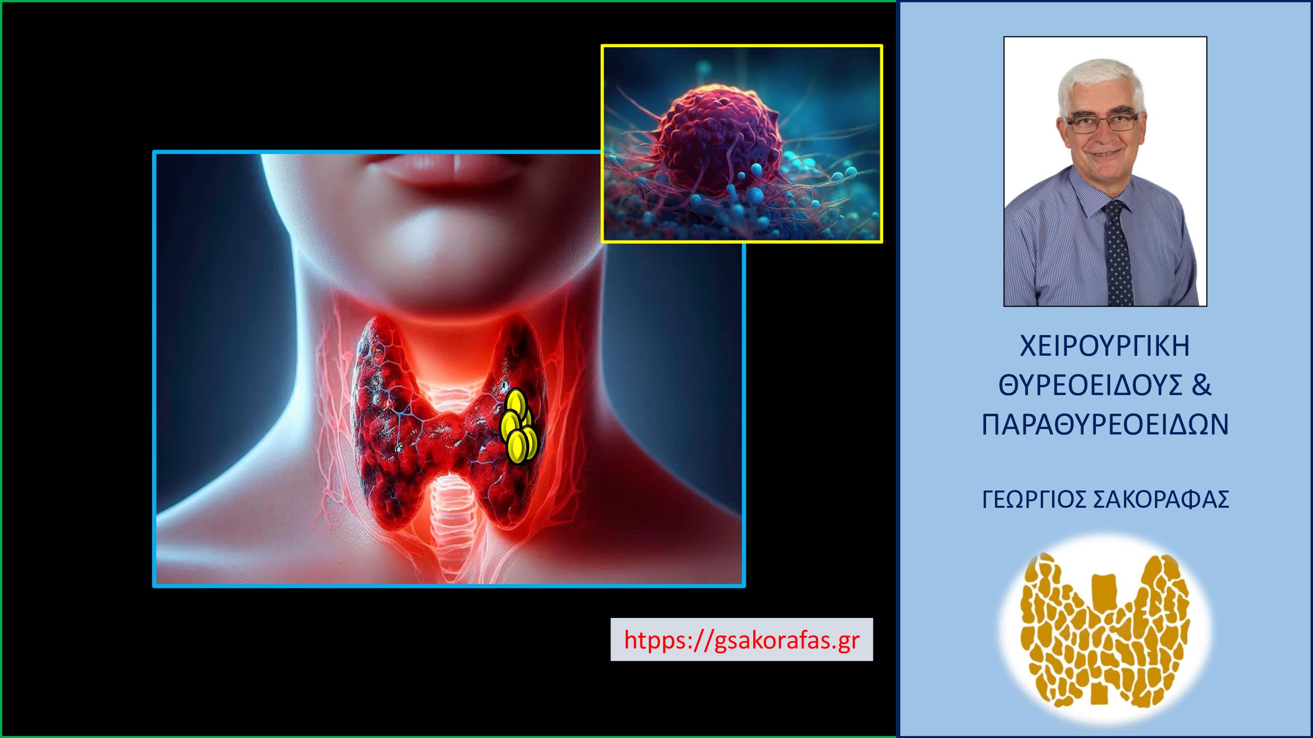 Καρκίνος θυρεοειδούς – Πώς συμπεριφέρεται; Πώς εξελίσσεται; Ποια είναι η πρόγνωσή του;