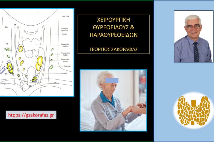 Καρκίνος θυρεοειδούς με λεμφαδενικές μεταστάσεις – ολική θυρεοειδεκτομή και λεμφαδενικός καθαρισμός τραχήλου με μία ημέρα νοσηλείας σε υπερήλικα ασθενή μας