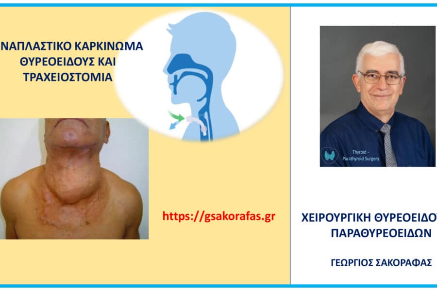 Αναπλαστικός καρκίνος θυρεοειδούς και τραχειοστομία – Γιατί και πότε μπορεί να χρειαστεί?