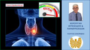 Καρκίνος θυρεοειδούς – πώς αντιμετωπίζονται οι ομάδες πληθυσμού αυξημένου κινδύνου για την ανάπτυξη καρκίνου θυρεοειδούς?