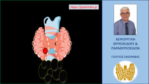 Καρκίνος θυρεοειδούς και η σημασία της εμπειρίας του ακτινολόγου – με αφορμή ασθενή μας. Το υπερηχογράφημα σε εξειδικευμένο εργαστήριο υπερήχων (βλ. κείμενο)
