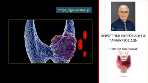 Καρκίνος θυρεοειδούς με μεταστάσεις στα πλάγια ανατομικά διαμερίσματα του τραχήλου – είναι πάντα απαραίτητος ο κεντρικός λεμφαδενικός καθαρισμός?