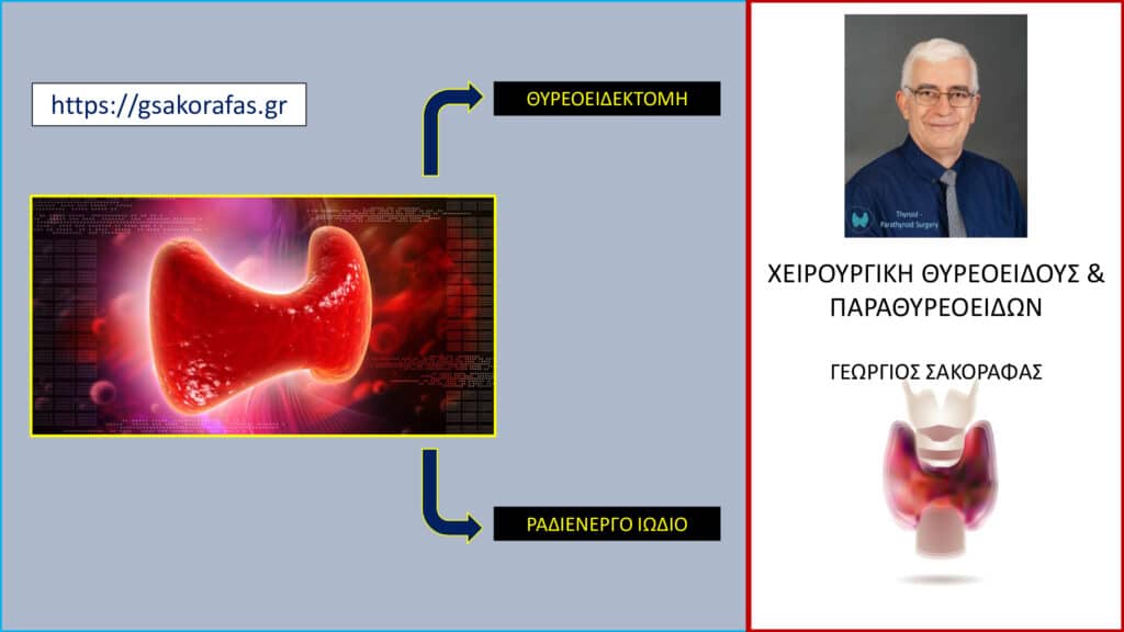 Υπερθυρεοειδισμός: τι πλεονεκτήματα έχει η θυρεοειδεκτομή (αφαίρεση θυρεοειδούς) σε σχέση με το ραδιενεργό ιώδιο;