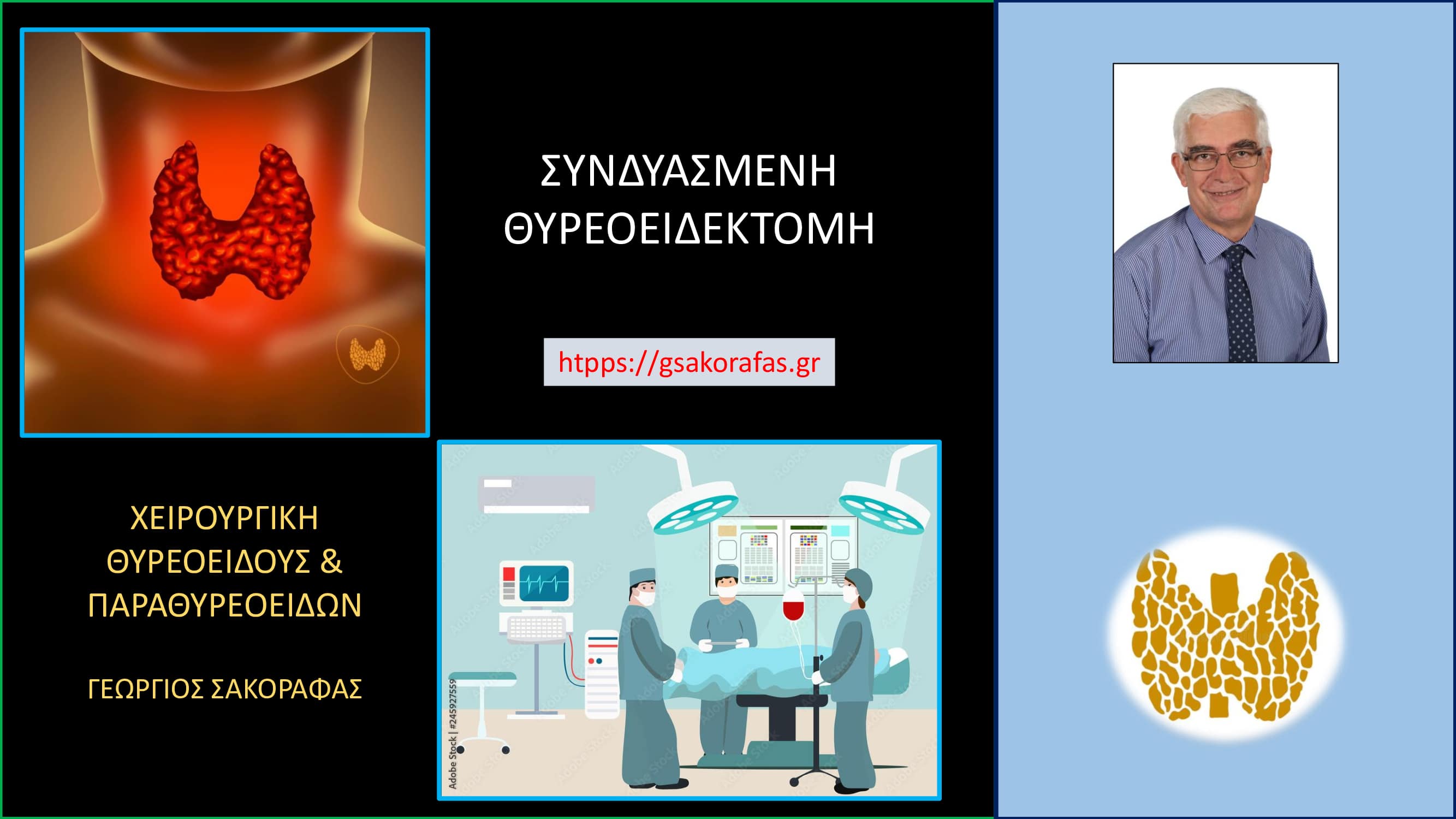 Συνδυασμένη θυρεοειδεκτομή – Τι είναι? Πότε χρειάζεται? Προϋποθέσεις και πλεονεκτήματα