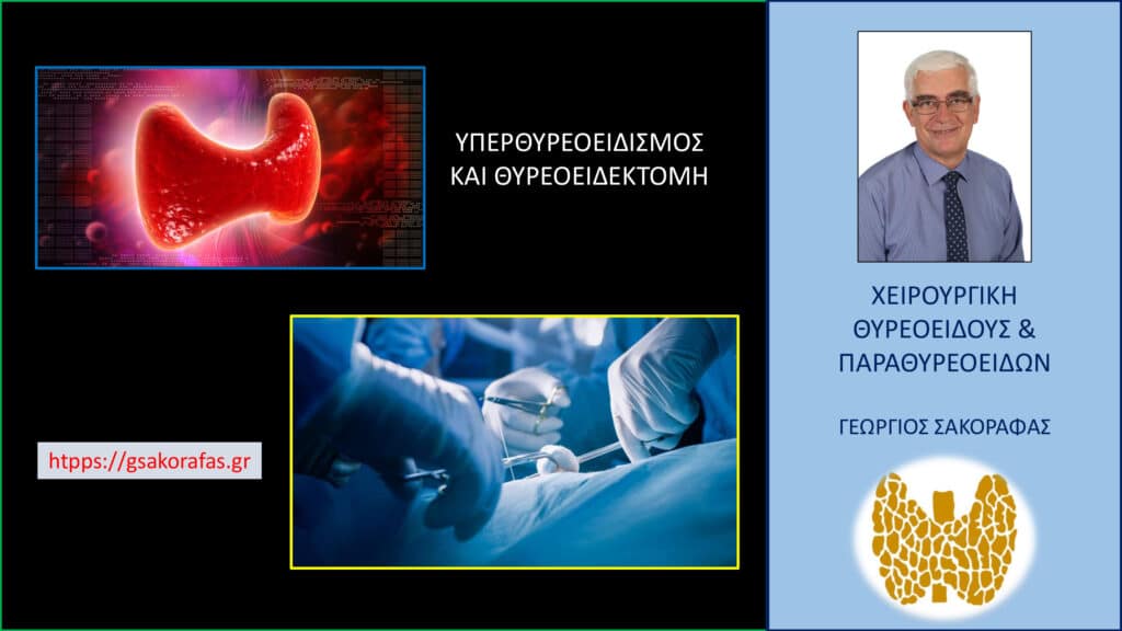 Υπερθυρεοειδισμός και Θυρεοειδεκτομή: Πότε Χρειάζεται Χειρουργική Αντιμετώπιση;