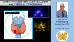 Καρκίνος θυρεοειδούς σε ασθενή μας με ιστορικό θεραπείας υπερθυρεοειδισμού με ραδιενεργό ιώδιο Καρκίνος θυρεοειδούς σε ασθενή μας με ιστορικό θεραπείας υπερθυρεοειδισμού με ραδιενεργό ιώδιο