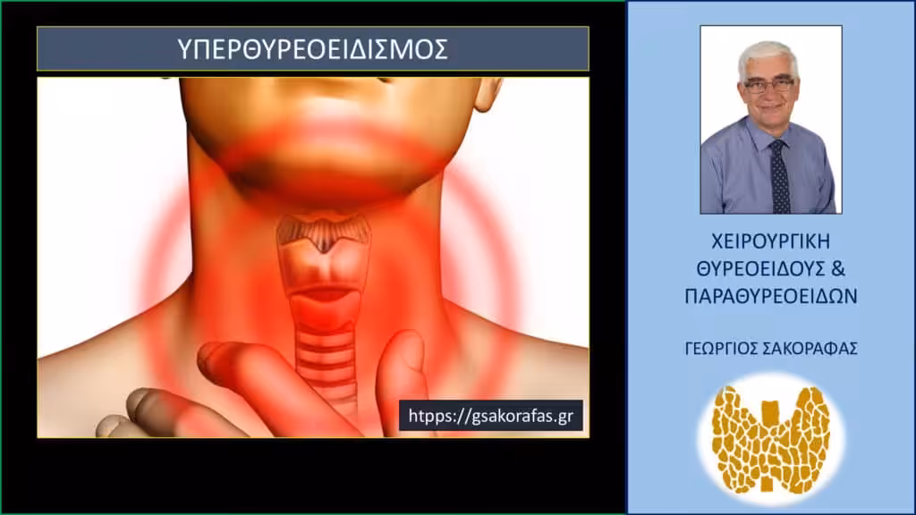 Υπερθυρεοειδισμός: 5 Συχνές Ερωτήσεις Και Απαντήσεις