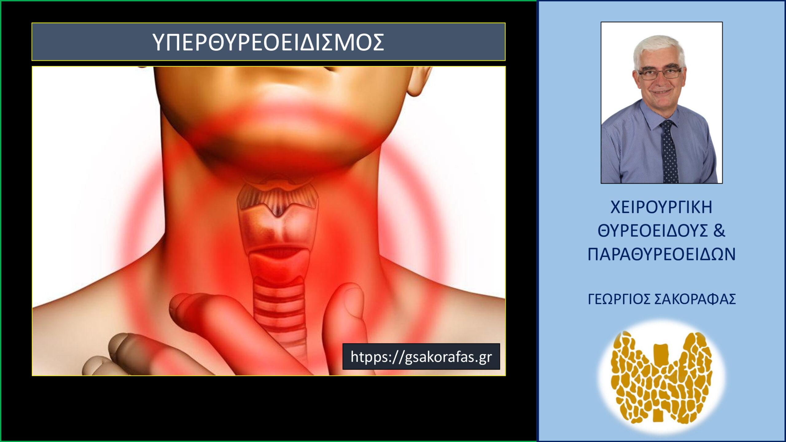 Υπερθυρεοειδισμός: 5 Συχνές Ερωτήσεις και Απαντήσεις