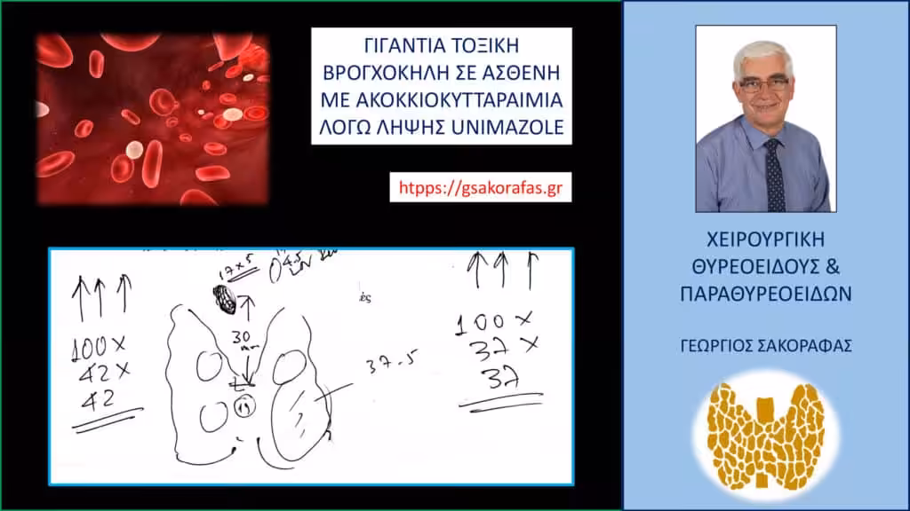 Γιγάντια Τοξική Βρογχοκήλη Σε Ασθενή Μας Με Ακοκκιοκυτταραιμία Λόγω Λήψης Unimazole Γιγάντια Τοξική Βρογχοκήλη Σε Ασθενή Μας Με Ακοκκιοκυτταραιμία Λόγω Λήψης Unimazole