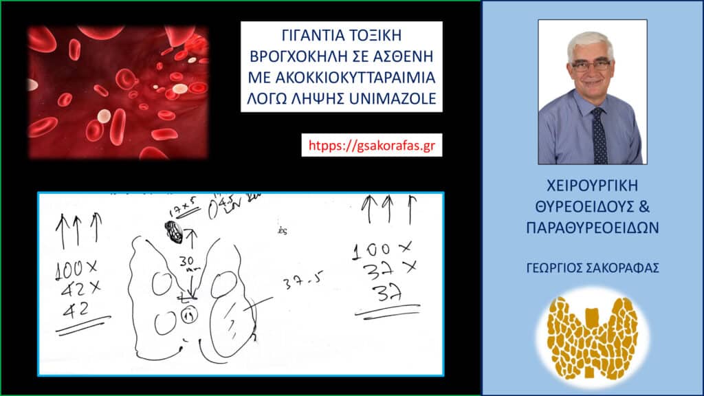 Γιγάντια τοξική βρογχοκήλη σε ασθενή μας με ακοκκιοκυτταραιμία λόγω λήψης unimazole