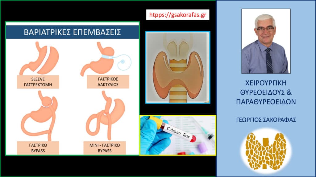 Υποασβεστιαιμία μετά θυρεοειδεκτομή και επεμβάσεις για την νοσογόνο παχυσαρκία. Επηρεάζουν οι βαριατρικές επεμβάσεις την απορρόφηση ασβεστίου?