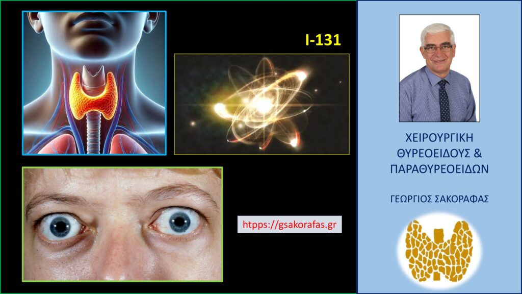 Νόσος Graves - Ραδιενεργό ιώδιο και θυρεοειδική οφθαλμοπάθεια