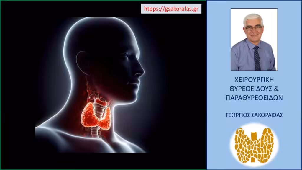 Υπερθυρεοειδισμός – Πότε Χρειάζεται Αφαίρεση Του Θυρεοειδούς;