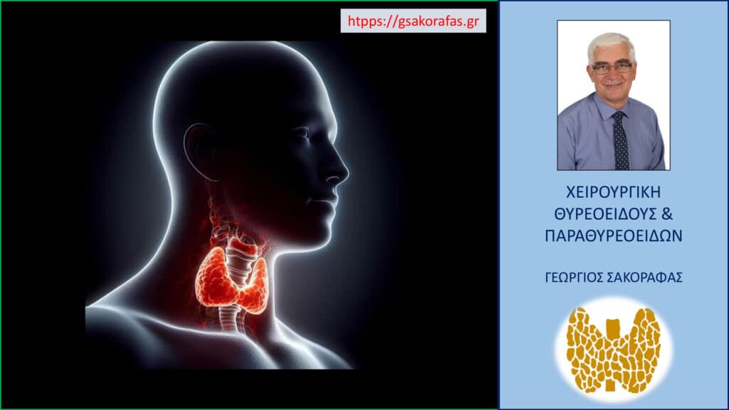 Υπερθυρεοειδισμός – Πότε Χρειάζεται Αφαίρεση του Θυρεοειδούς;