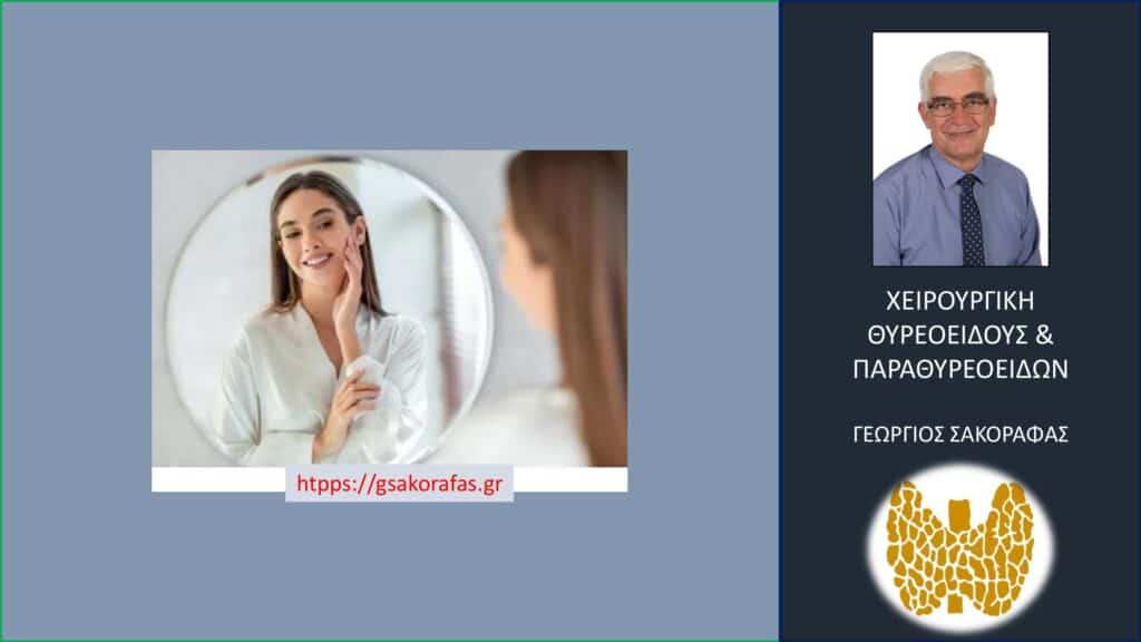 Θυρεοειδεκτομή και ουλή: 5 Συχνές Ερωτήσεις και Απαντήσεις
