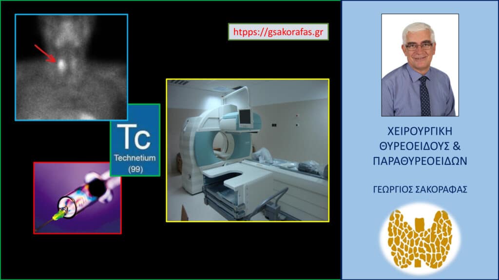 Αδένωμα παραθυρεοειδούς και σπινθηρογράφημα παραθυρεοειδών με Tc99m sestamibi – οδηγίες προστασίας από την ακτινοβολία (ακτινοπροστασίας)