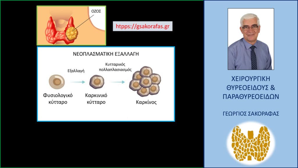 Όζοι θυρεοειδούς – μπορούν να εξαλλαγούν σε καρκίνο?