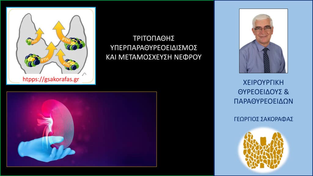 Home Υπερπαραθυρεοειδισμός σε νεφροπαθείς ασθενείς (τριτοπαθής υπερπαραθυρεοειδισμός) που πρόκειται να υποβληθούν σε μεταμόσχευση νεφρού– γιατί πρέπει να αντιμετωπίζεται χειρουργικά πριν την μεταμόσχευση?