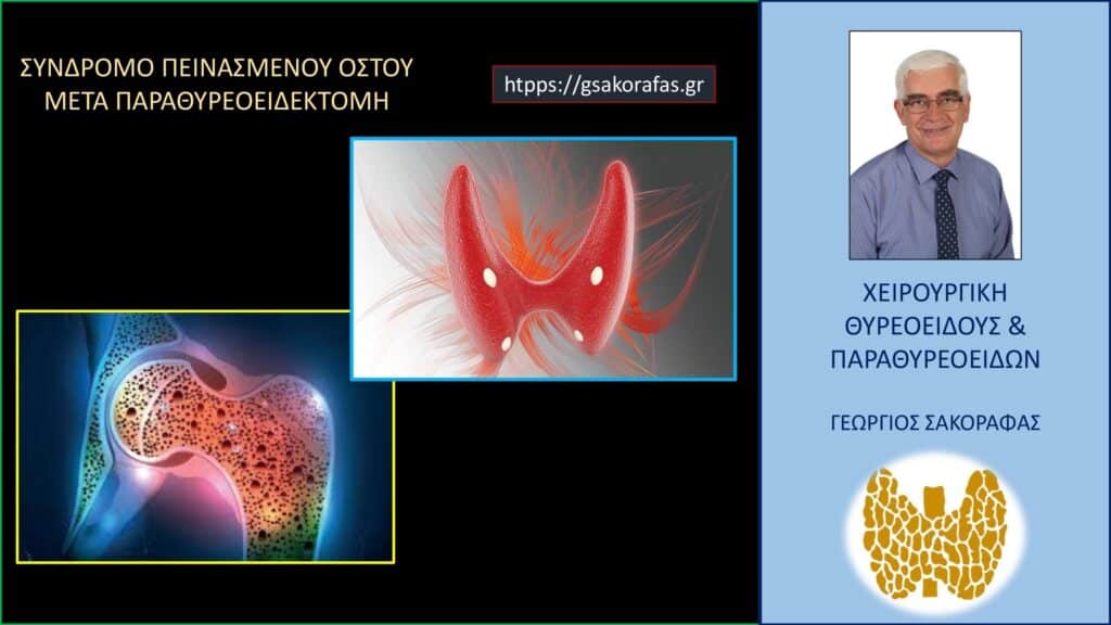 Home Σύνδρομο πεινασμένου οστού (hungry bone syndrome) μετά από παραθυρεοειδεκτομή