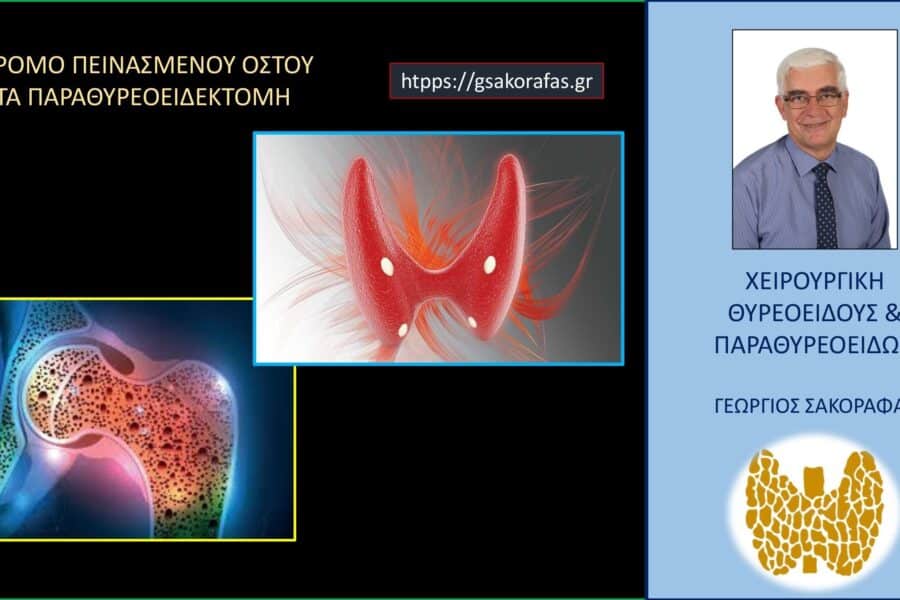 Σύνδρομο πεινασμένου οστού (hungry bone syndrome) μετά από παραθυρεοειδεκτομή