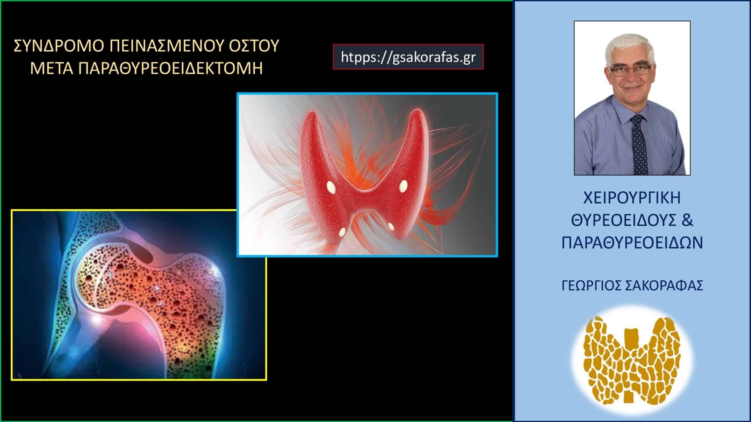 Σύνδρομο πεινασμένου οστού (hungry bone syndrome) μετά από παραθυρεοειδεκτομή