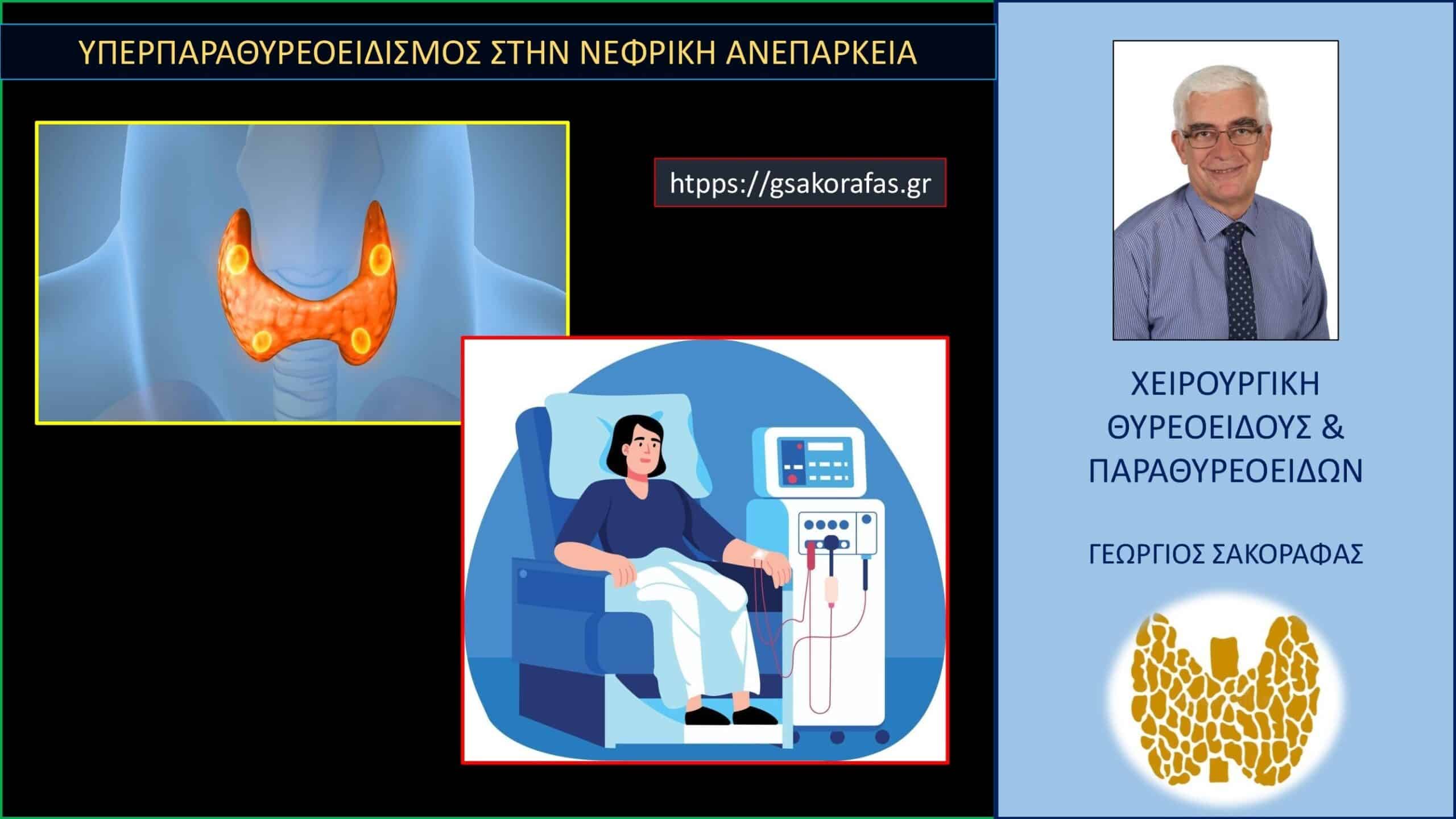 Υπερπαραθυρεοειδισμός – με ποιόν μηχανισμό προκαλείται στην νεφρική ανεπάρκεια;