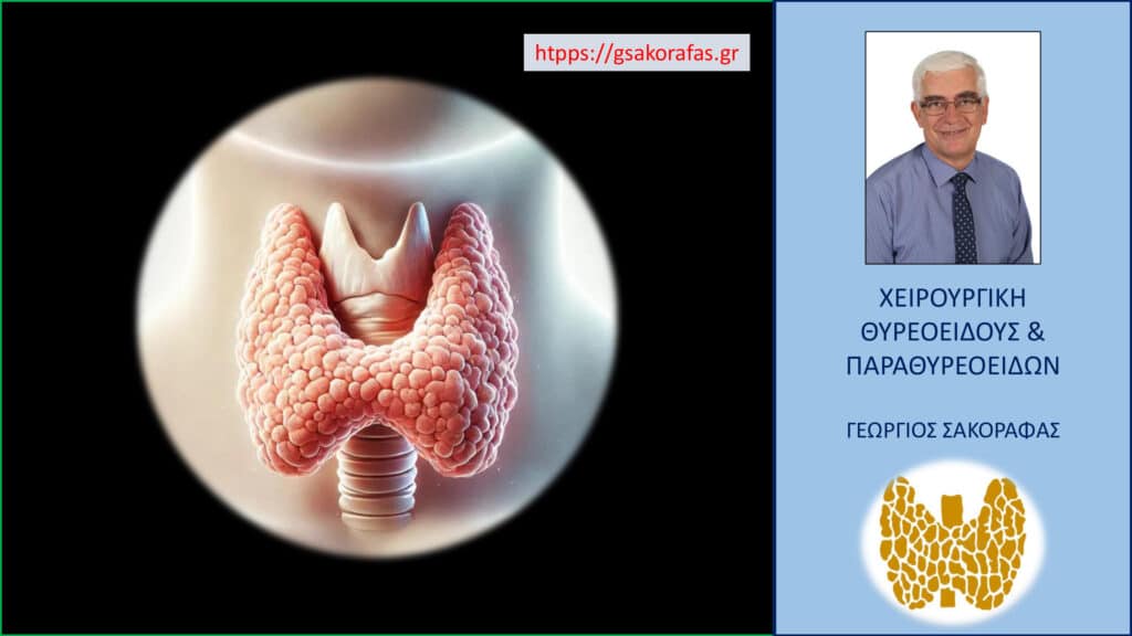 Home Θυρεοειδής και οι παθήσεις του – 8 συχνές ερωτήσεις και απαντήσεις από έναν χειρουργό θυρεοειδούς και παραθυρεοειδών